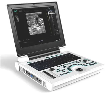 Продается ультразвуковое медицинское оборудование для ноутбука в больнице, ультразвуковой диагностический инструмент